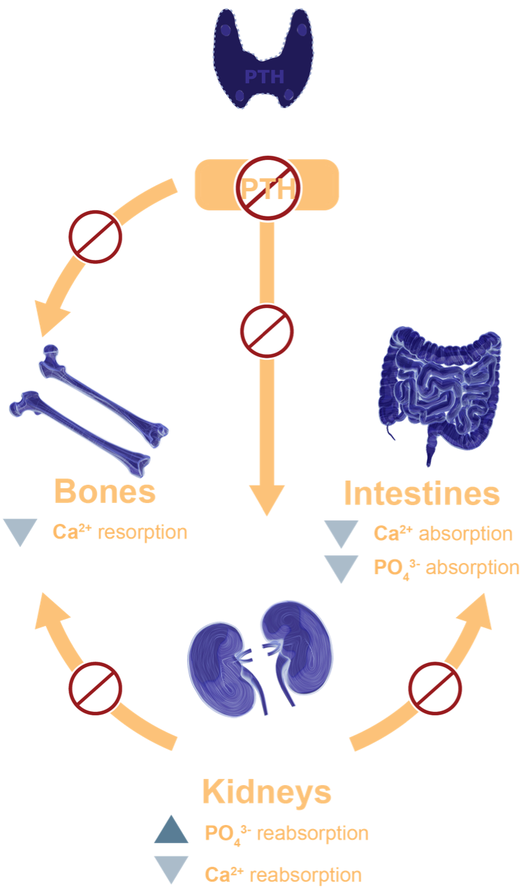 pathophysiology of hypopara